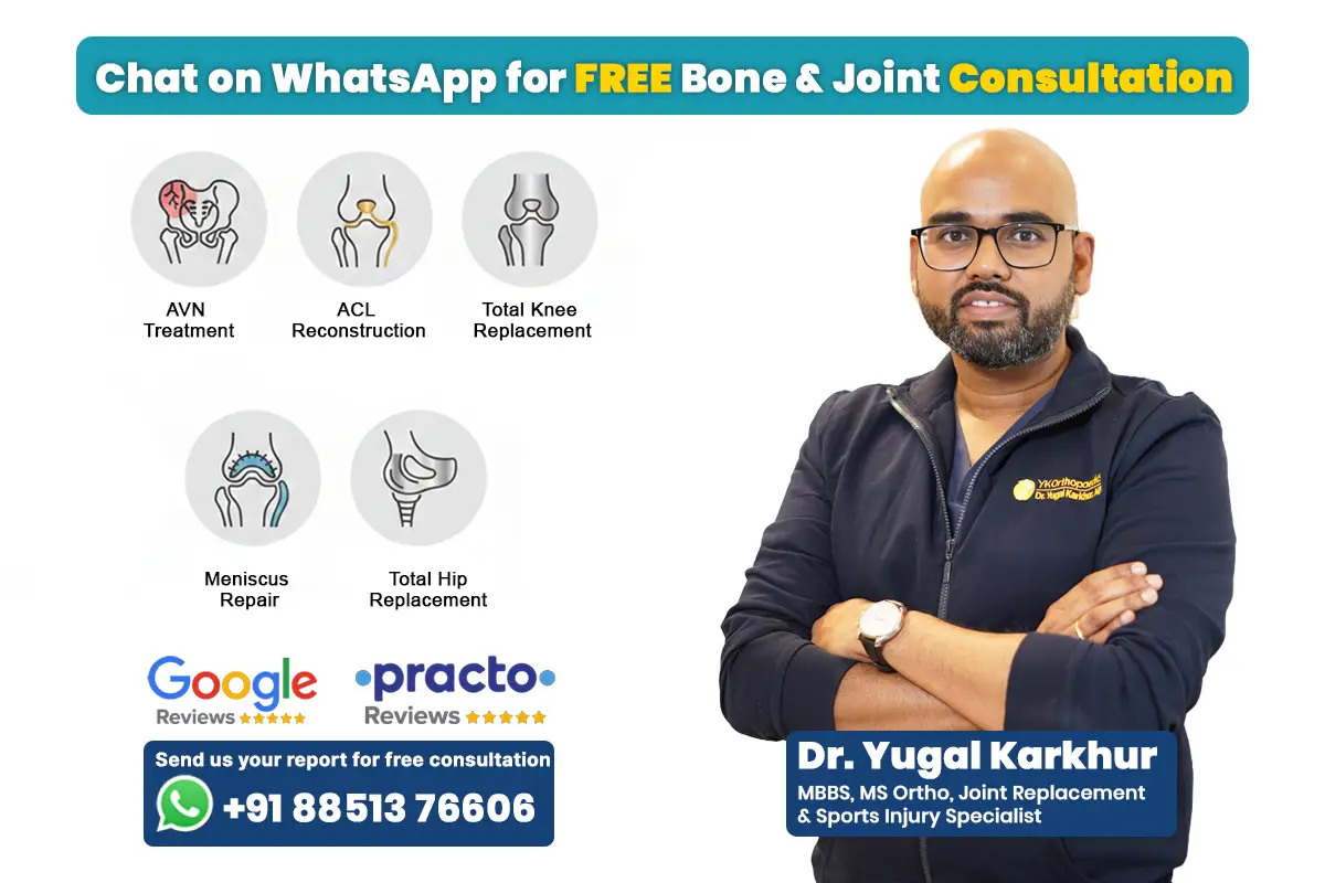 Total Knee Replacement Surgery