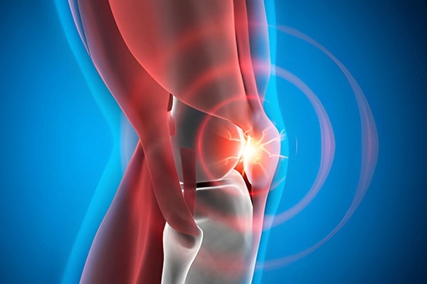 ACL Reconstruction Surgery