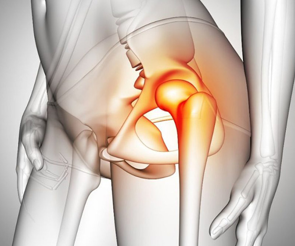 What is AVN Treatment?