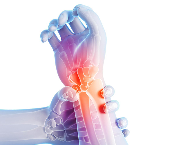 What is  Carpal Tunnel Surgery?