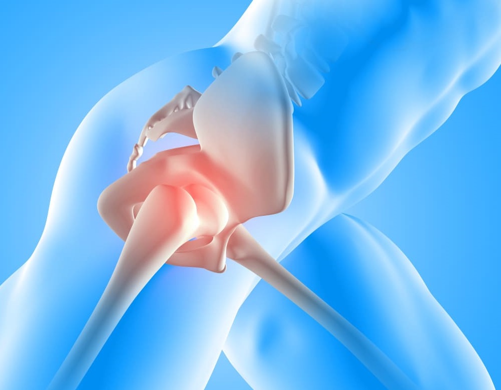 Diagnosis before AVN Treatment