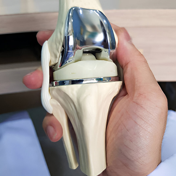 Types of Partial Knee Replacement