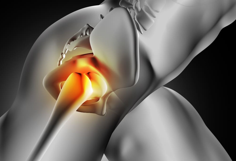 Why AVN Treatment is Done