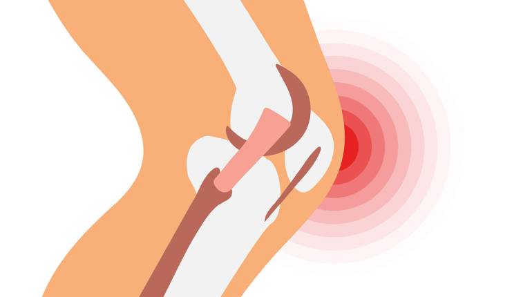When You Need Arthroscopic Meniscus Repairing