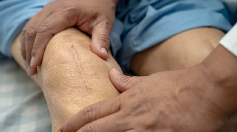 How To Manage Pain After Total Knee Replacement Surgery?