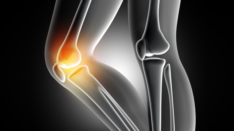 Tips on Keeping Joints Limber, Healthy As You Age