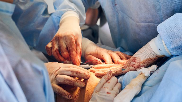 4 Things We Now Know About Hip Replacement Surgery