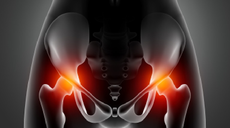 Accelerating Recovery: Mastering the Art of Healing After Hip Replacement Surgery