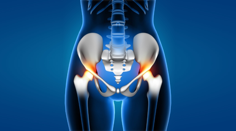 Role of a Good Surgeon in Explaining Facts for a Total Hip Replacement