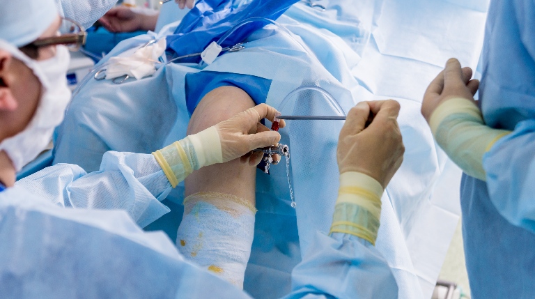 When Do You Need A Knee Arthroscopic Surgery?