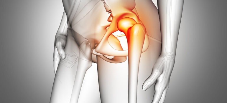 The complete procedure of Total Hip Arthroplasty explained