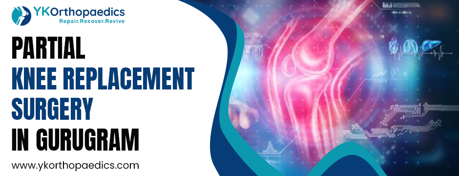 Reclaim Your Active Life with Partial Knee Replacement Surgery in Gurugram