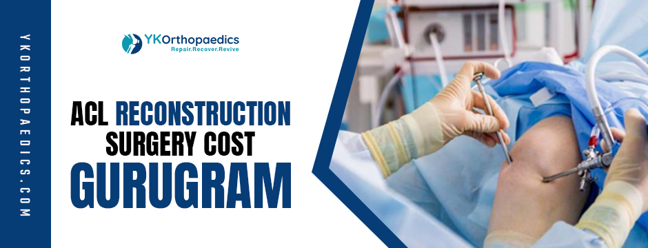 Breaking Down the Cost of ACL Reconstruction Surgery in Gurugram