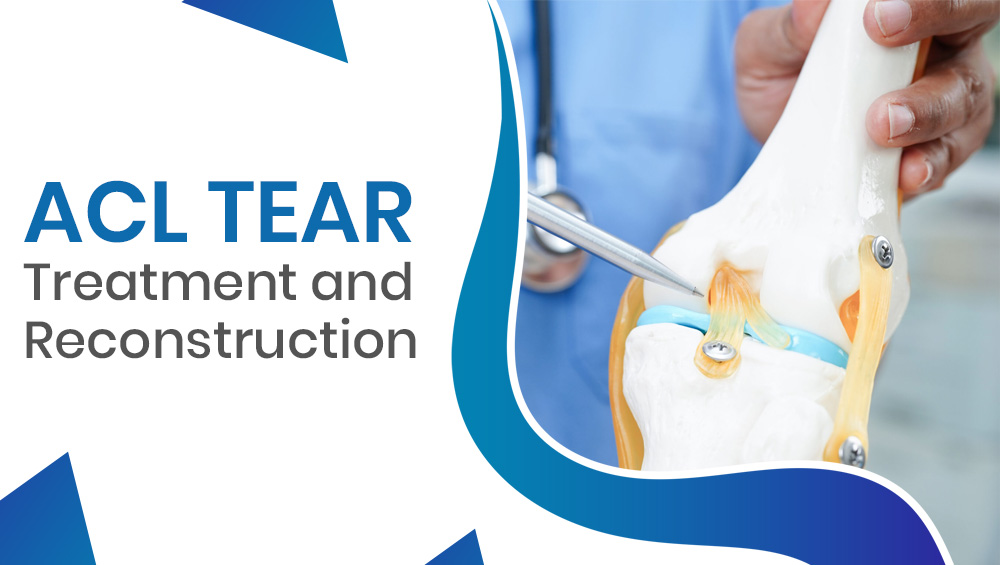ACL Tear Treatment and Reconstruction