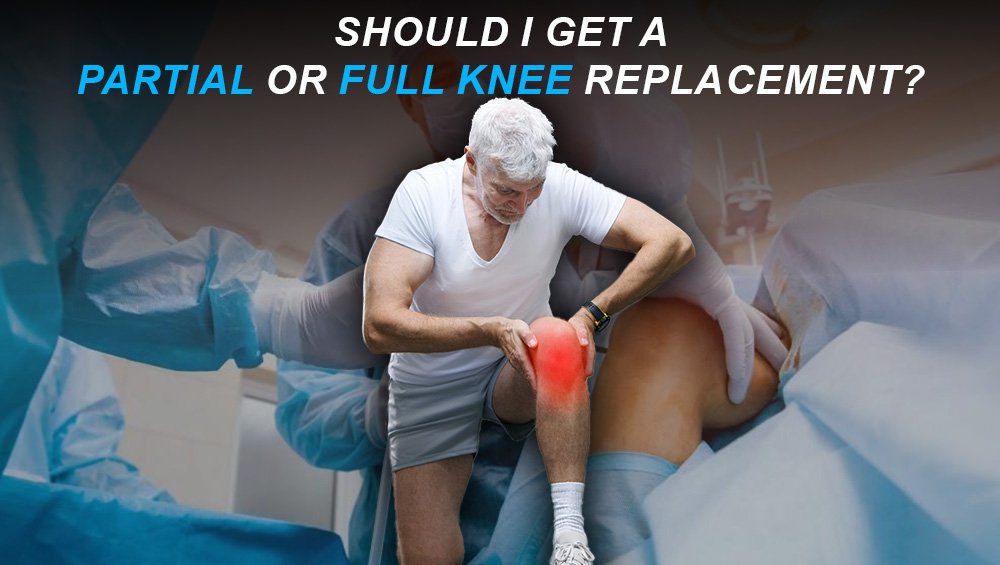 Should I Get A Partial Or Full Knee Replacement?