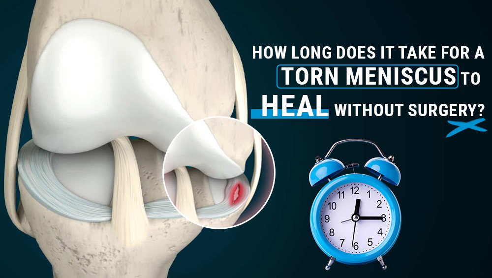 How Long Does It Take for a Torn Meniscus to Heal Without Surgery?