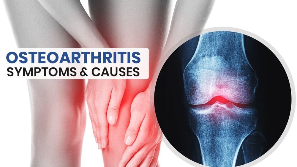 Osteoarthritis – Symptoms & Causes