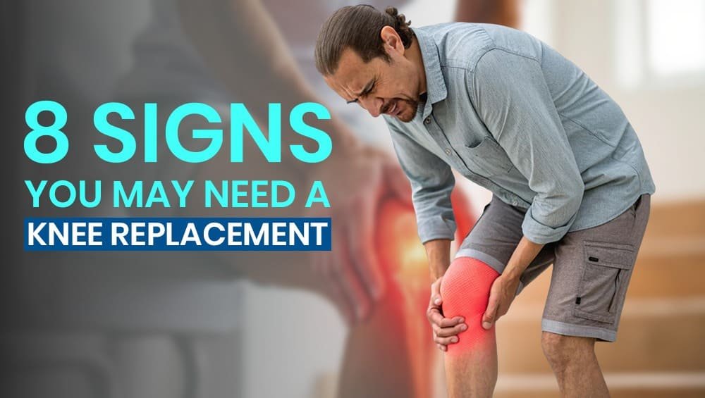8 Signs You May Need a Knee Replacement