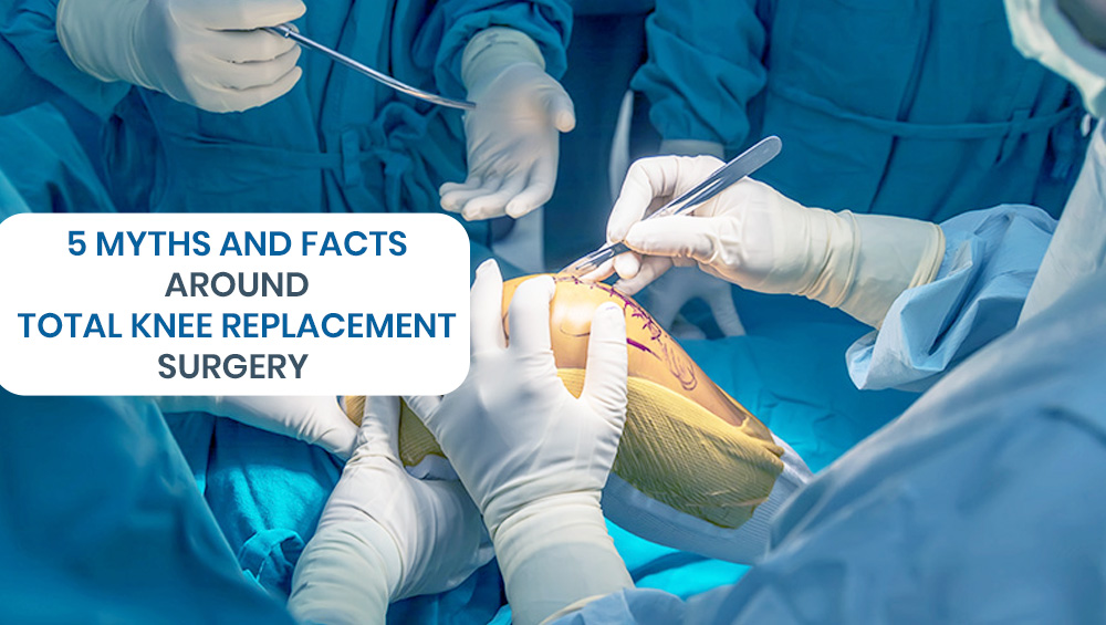 5 Myths and Facts Around Total Knee Replacement Surgery