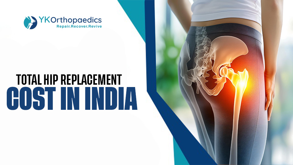 Total Hip Replacement Cost in India