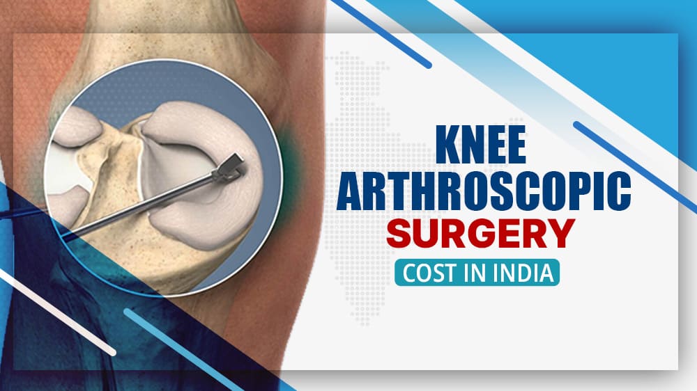 Knee Arthroscopy Surgery Cost in India