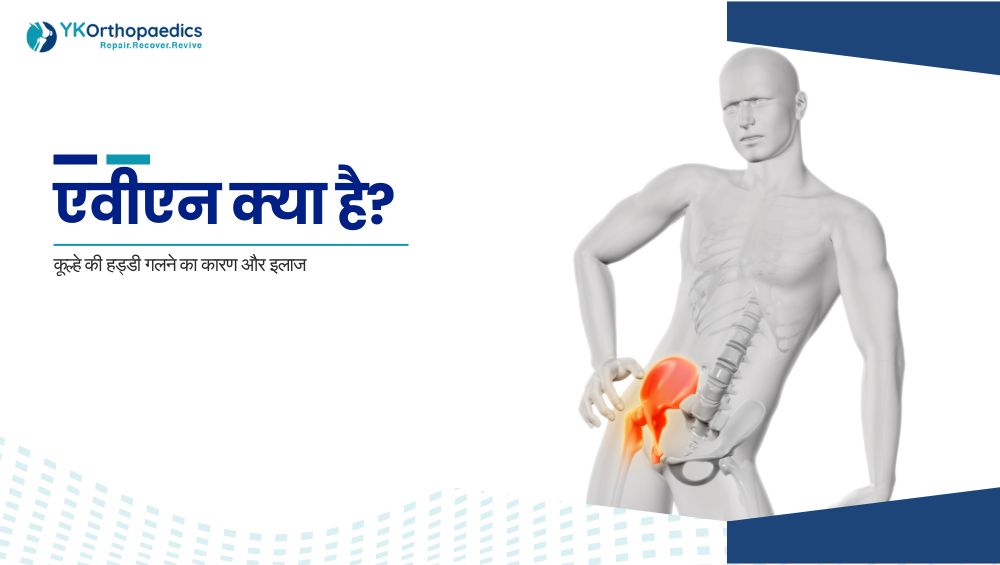 एवीएन क्या है? कूल्हे की हड्डी गलने का कारण और इलाज