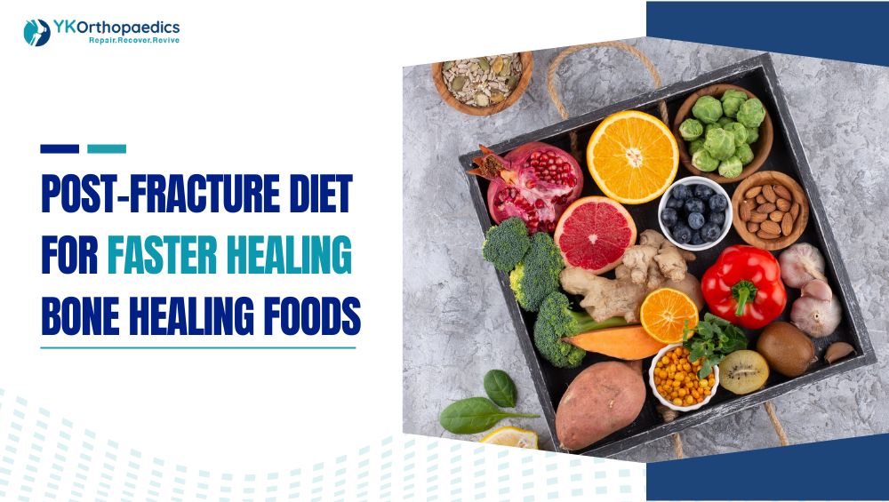 Post-Fracture Diet for Faster Healing