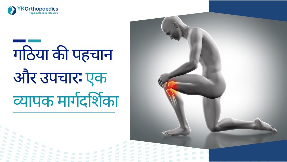 गठिया की पहचान और उपचार: एक व्यापक मार्गदर्शिका