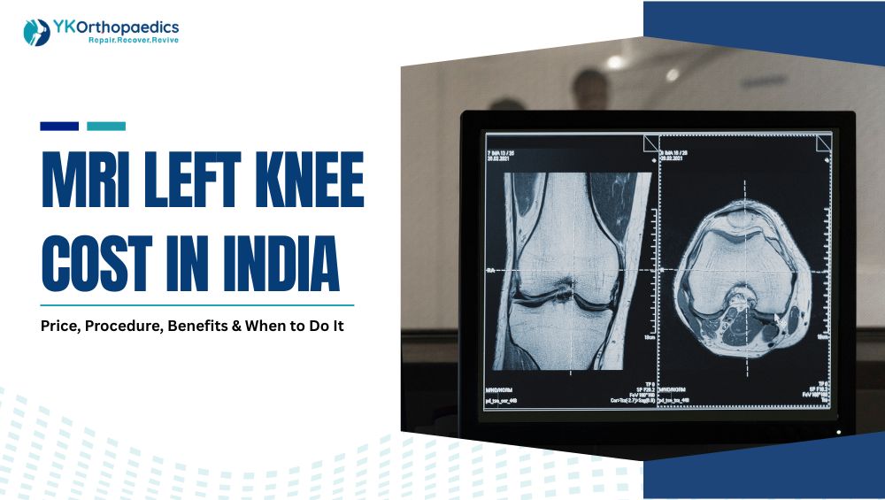 MRI Left Knee Cost in India: Price, Procedure, Benefits & When to Do It