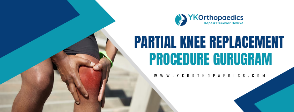 Partial knee replacement procedure gurugram