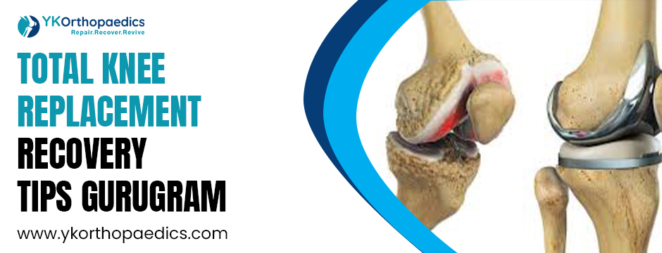 Total knee replacement recovery tips gurugram